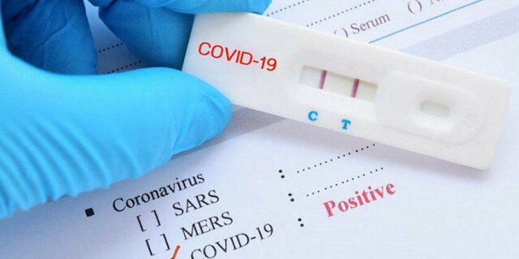 Korona Virüs Testi Pozitif Çıkan SMMM’ ler İçin Mücbir Sebep Başvuru Yol Haritası